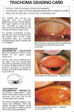 Trachoma-simplified-grading-card-verso-Eng